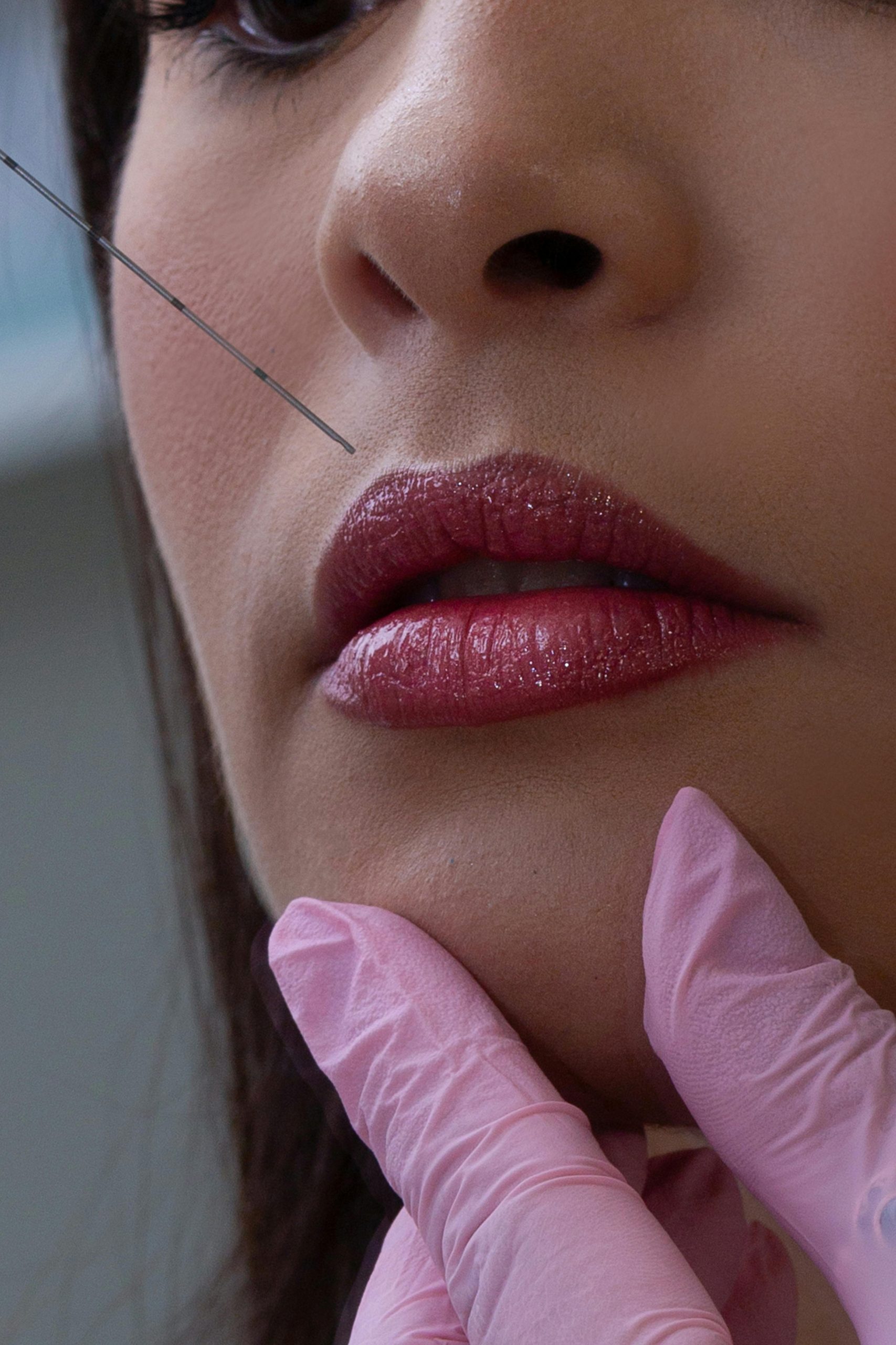 Close-up of a woman's lips receiving a cosmetic filler injection in a clinic setting.